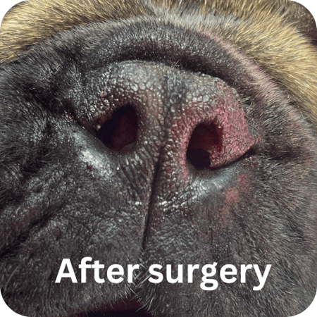 boas surgery recovery